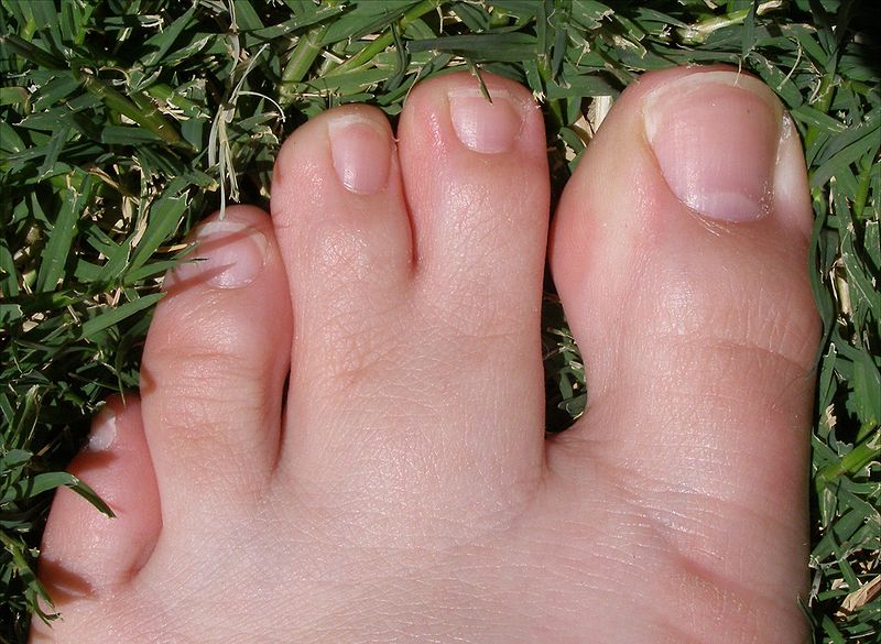 wikiconnectedtoes.jpg